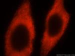 RPL24 Antibody in Immunocytochemistry (ICC/IF)