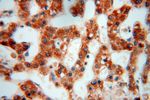 RPL24 Antibody in Immunohistochemistry (Paraffin) (IHC (P))