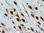 LUC7L Antibody in Immunohistochemistry (Paraffin) (IHC (P))