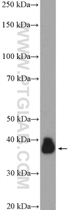 LUC7L Antibody in Western Blot (WB)