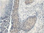 PDPK1 Antibody in Immunohistochemistry (Paraffin) (IHC (P))