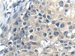 PDPK1 Antibody in Immunohistochemistry (Paraffin) (IHC (P))