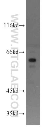 PDPK1 Antibody in Western Blot (WB)