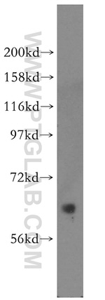 PDPK1 Antibody in Western Blot (WB)