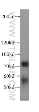 TUBGCP4 Antibody in Western Blot (WB)