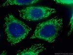 OAT Antibody in Immunocytochemistry (ICC/IF)