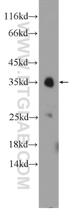 MFF Antibody in Western Blot (WB)