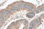 LARS2 Antibody in Immunohistochemistry (Paraffin) (IHC (P))