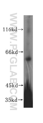 DCTN4 Antibody in Western Blot (WB)