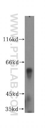 DCTN4 Antibody in Western Blot (WB)