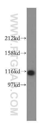 OGDHL Antibody in Western Blot (WB)