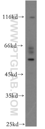 UPF3A Antibody in Western Blot (WB)