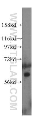 OMA1 Antibody in Western Blot (WB)