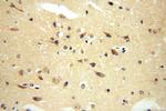 RASGEF1A Antibody in Immunohistochemistry (Paraffin) (IHC (P))