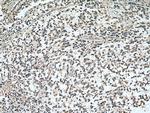 RASGEF1A Antibody in Immunohistochemistry (Paraffin) (IHC (P))