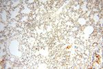 OXCT2 Antibody in Immunohistochemistry (Paraffin) (IHC (P))