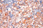 OXCT2 Antibody in Immunohistochemistry (Paraffin) (IHC (P))