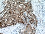 ACSS1 Antibody in Immunohistochemistry (Paraffin) (IHC (P))