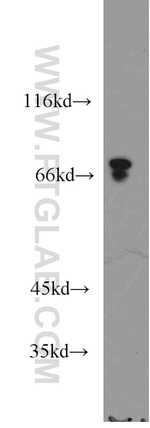 ACSS1 Antibody in Western Blot (WB)