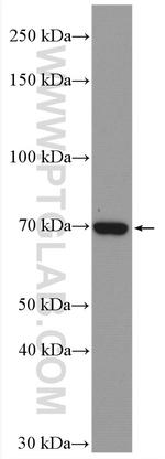 ACSS1 Antibody in Western Blot (WB)