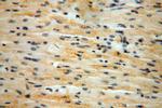 B3GALNT2 Antibody in Immunohistochemistry (Paraffin) (IHC (P))