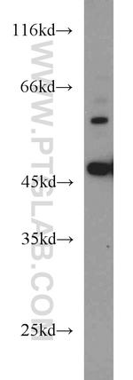 B3GALNT2 Antibody in Western Blot (WB)