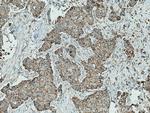 PYCR2 Antibody in Immunohistochemistry (Paraffin) (IHC (P))