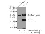 PYCR2 Antibody in Immunoprecipitation (IP)