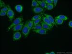 YARS2 Antibody in Immunocytochemistry (ICC/IF)