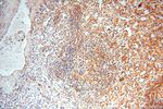 YARS2 Antibody in Immunohistochemistry (Paraffin) (IHC (P))