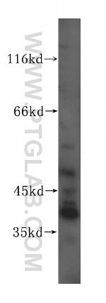 TCEA3 Antibody in Western Blot (WB)