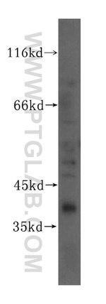 TCEA3 Antibody in Western Blot (WB)
