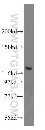 ACAD10 Antibody in Western Blot (WB)