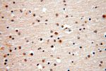 APOBEC4 Antibody in Immunohistochemistry (Paraffin) (IHC (P))