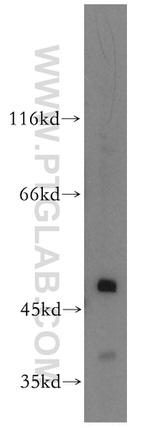 APOBEC4 Antibody in Western Blot (WB)