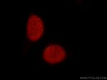 Histone-H3 Antibody in Immunocytochemistry (ICC/IF)