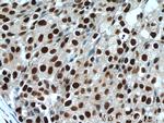 Histone-H3 Antibody in Immunohistochemistry (Paraffin) (IHC (P))