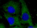 LOH12CR1 Antibody in Immunocytochemistry (ICC/IF)