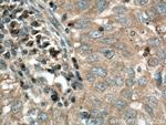 LOH12CR1 Antibody in Immunohistochemistry (Paraffin) (IHC (P))