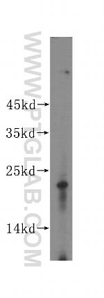 LOH12CR1 Antibody in Western Blot (WB)