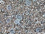 IARS2 Antibody in Immunohistochemistry (Paraffin) (IHC (P))