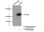 IARS2 Antibody in Immunoprecipitation (IP)