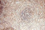 FUT11 Antibody in Immunohistochemistry (Paraffin) (IHC (P))