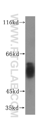 FUT11 Antibody in Western Blot (WB)