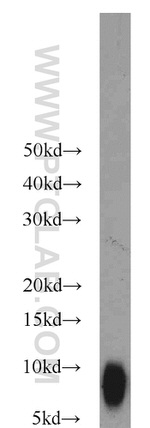 TNP1 Antibody in Western Blot (WB)