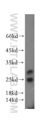 METTL11A Antibody in Western Blot (WB)