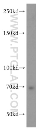 ZFP64 Antibody in Western Blot (WB)