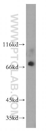 ZFP64 Antibody in Western Blot (WB)