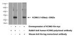 KCNN3 Antibody in Western Blot (WB)