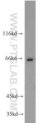 CBFA2T3 Antibody in Western Blot (WB)